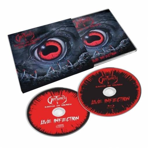 Cause Of Death Live Infection CD+BLURAY